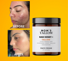 Skin Serenity Face Cream – Nourishing Balm for Sensitive & Flaky Skin