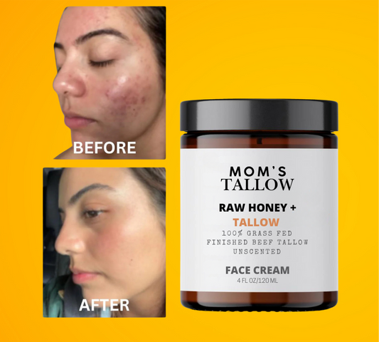 Skin Serenity Face Cream – Nourishing Balm for Sensitive & Flaky Skin