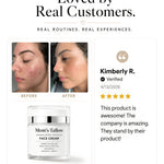 Mom’s Tallow Advanced Peptide Face Cream customer review with before-and-after skin results and five-star testimonial