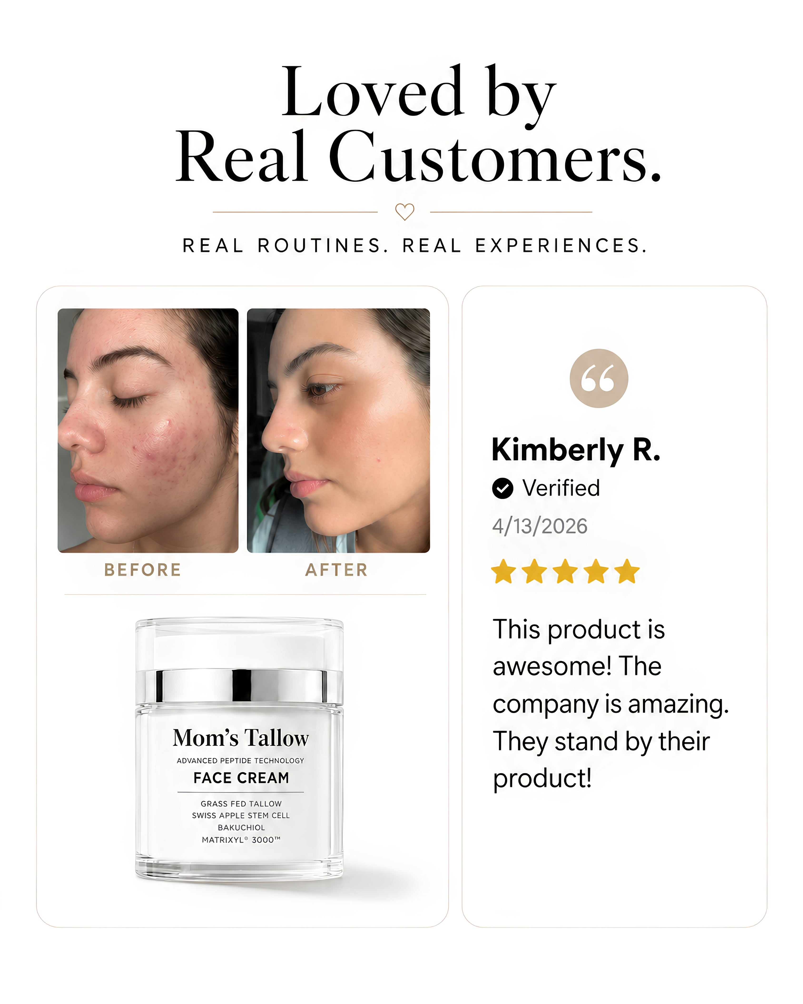 Mom’s Tallow Advanced Peptide Face Cream customer review with before-and-after skin results and five-star testimonial